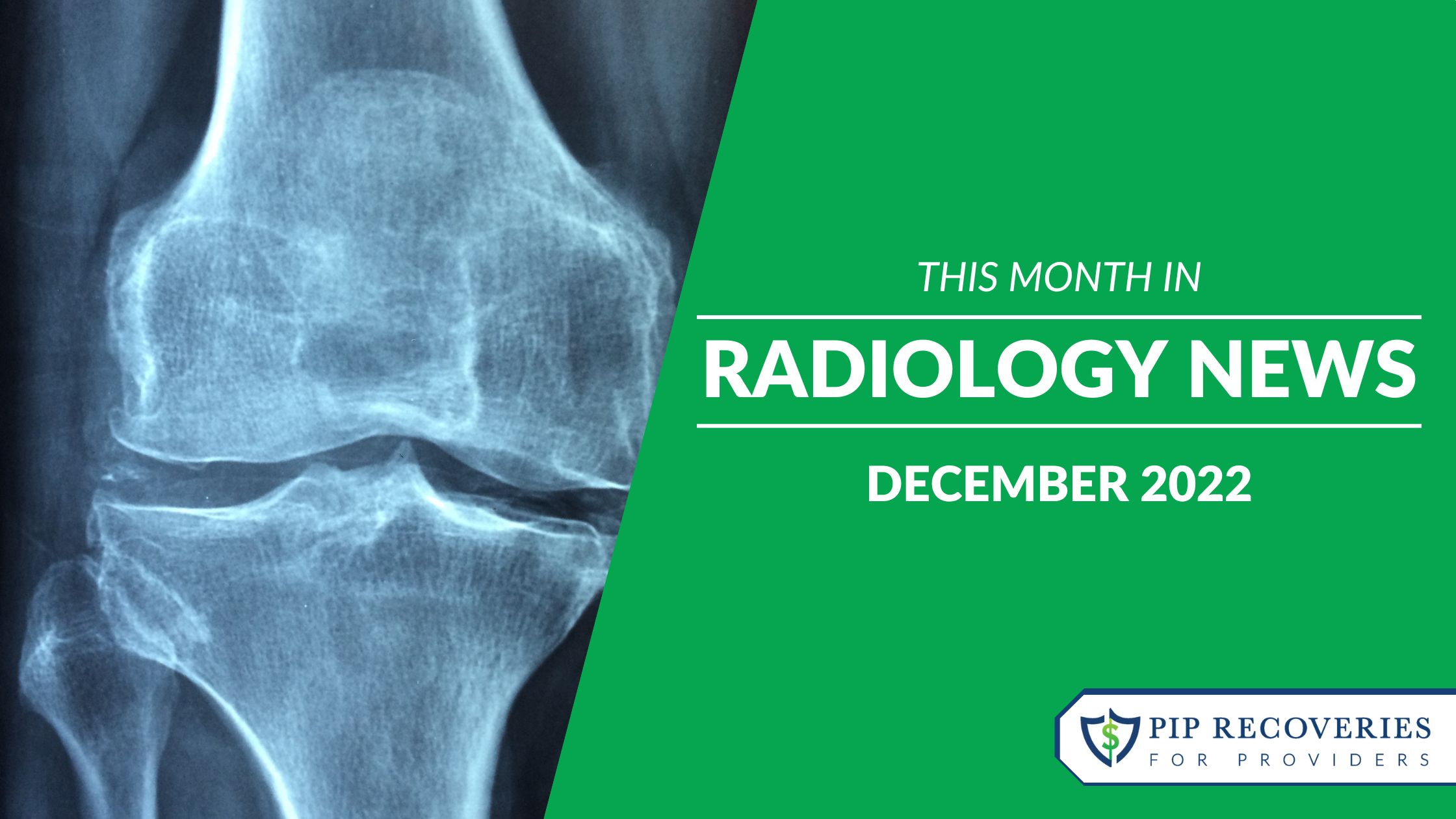 This Month in Radiology News - December 2022